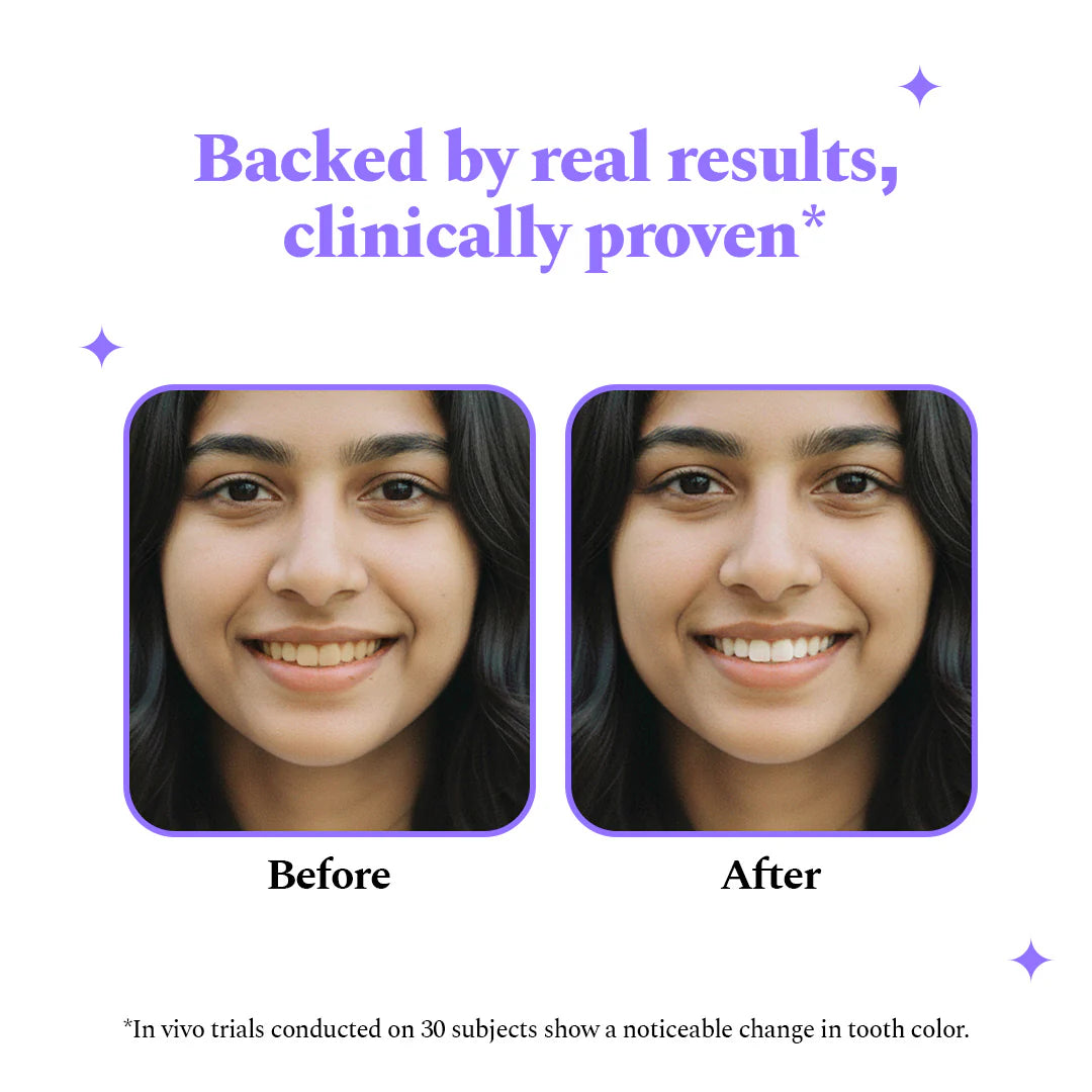Purple Magic™ Teeth Whitening Strips