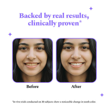 Purple Magic™ Teeth Whitening Strips
