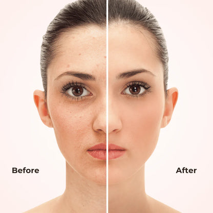 GlowEra 2-in-1 Foundation + Concealer Stick with SPF 50